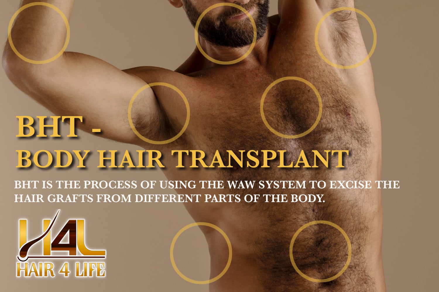 BHT - Body Hair Transplant - Hair 4 LIfe