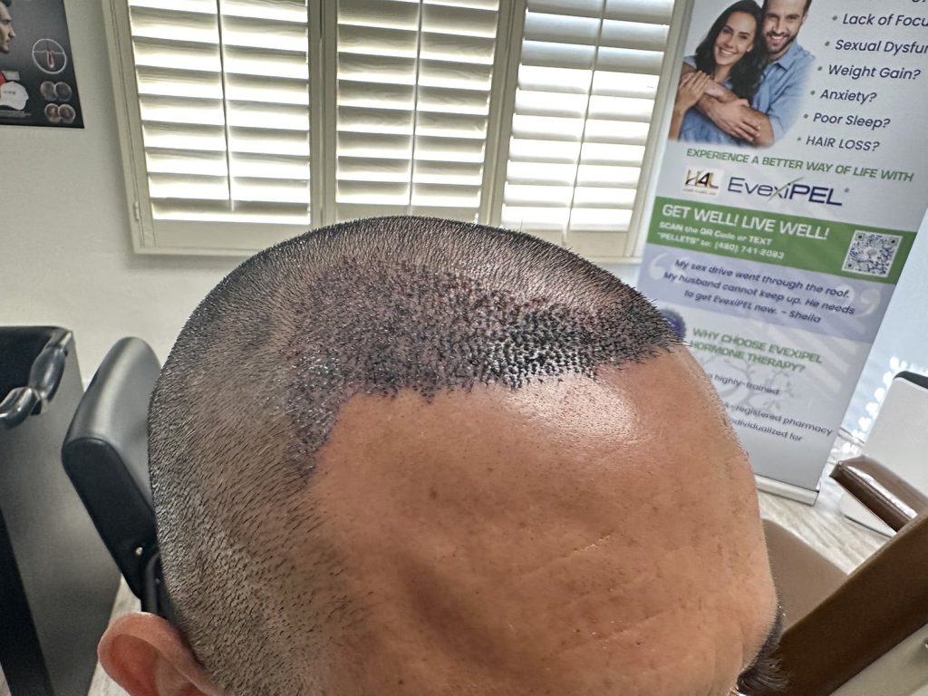 Hair 4 Life Medical - Dr. Kelemen