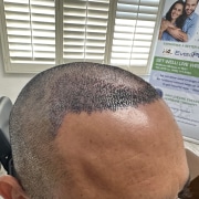 Hair 4 Life Medical - Dr. Kelemen