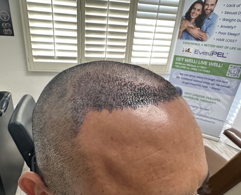 Hair 4 Life Medical - Dr. Kelemen