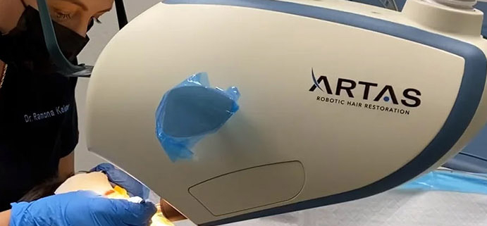 ARTAS-Robotic-Hair-Restoration-Hair 4 LIfe