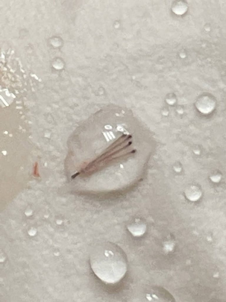 BHT - Body Hair Transplant 1