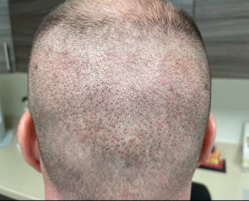 Hair 4 Life Medical - Dr. Kelemen