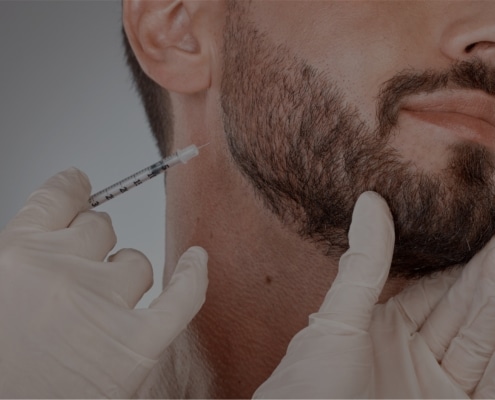 Injectables for beard hair maintenance