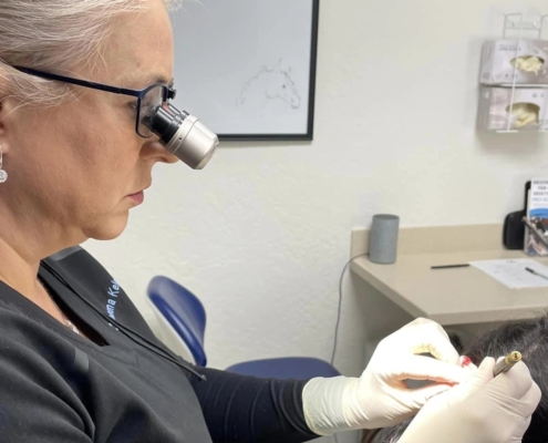 Dr Kelemen during one of her SOLO hair transplant sessions.