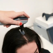 non surgical hair loss treatment