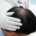 FUE Crown Hair Transplant