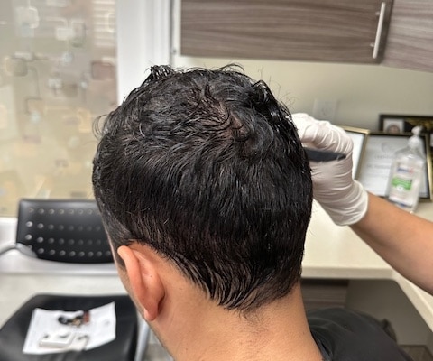 Dr Kelemen teaching the patient how to take care of their freshly transplanted hair and donor area.