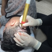 Dr Kelemen No Shave Fue