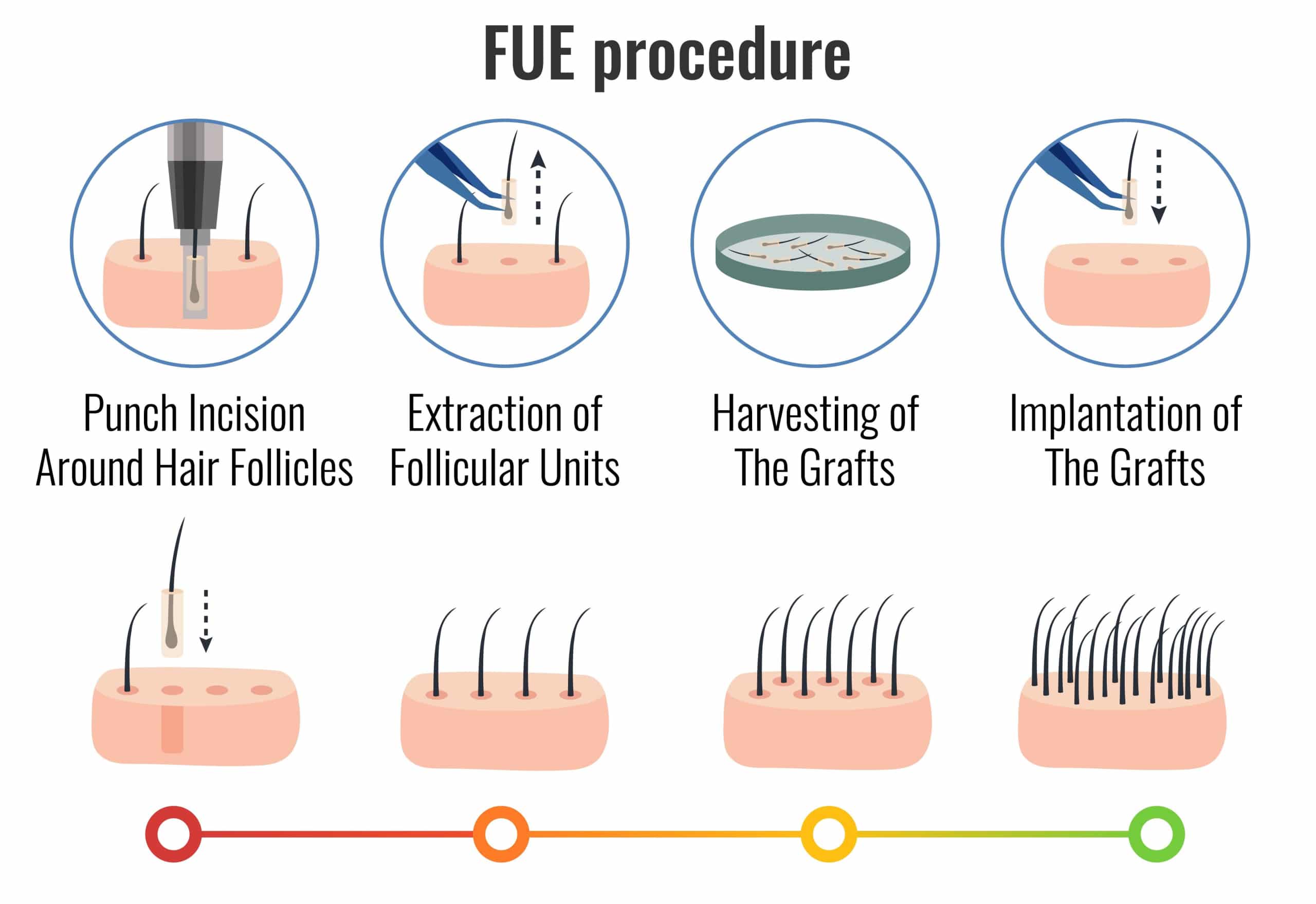 FUE procedure in detail