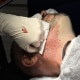 Beard to scalp Hybrid