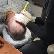 Hair-transplant with Dr Kelemen using the wireless WAW system