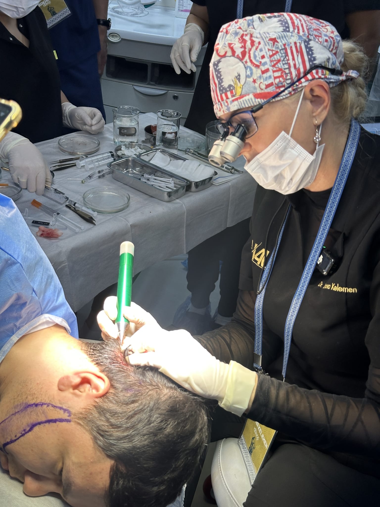 NO Shave FUE demonstration by Dr Kelemen