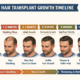 HAIRGROWTHTIMELINE - Hair 4 Life Medical