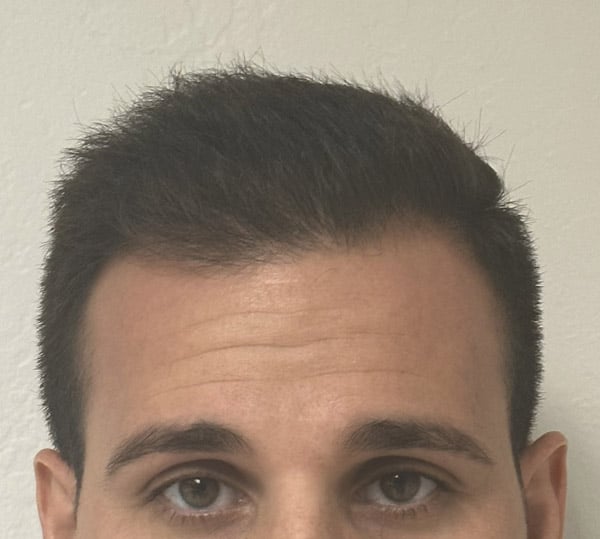 After