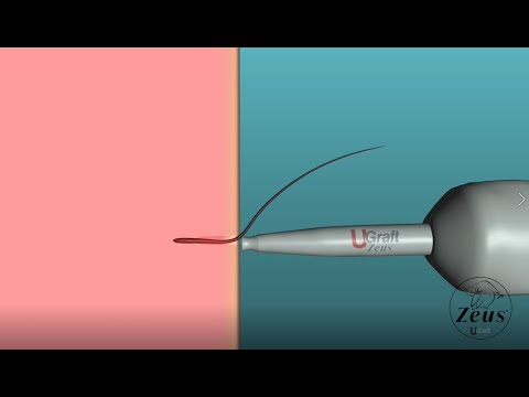 youtube placeholder image